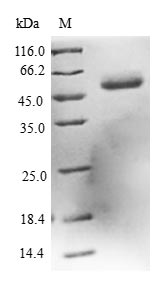 Greater than 90% as determined by SDS-PAGE.Recombinant Human L-Xylulose Reductase (DCXR) Protein (GST)