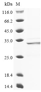 Greater than 85% as determined by SDS-PAGE.Recombinant Cat Troponin I, Cardiac Muscle (TNNI3) Protein (His)