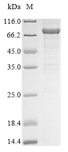 Greater than 85% as determined by SDS-PAGE.Recombinant Human Probable Atp-Dependent Rna Helicase Ddx53 (DDX53) Protein (His&Myc)
