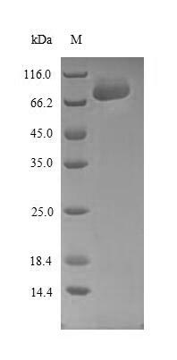 Greater than 85% as determined by SDS-PAGE.Recombinant Human Sprouty-Related, Evh1 Domain-Containing Protein 1 (SPRED1) Protein (His-SUMO&Myc)