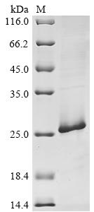 Greater than 85% as determined by SDS-PAGE.Recombinant Human Brca1-Associated Protein (BRAP) Protein (His)