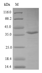 Greater than 85% as determined by SDS-PAGE.Recombinant Human Valacyclovir Hydrolase (BPHL) Protein (His&Myc)