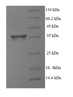 Greater than 90% as determined by SDS-PAGE.Recombinant Human Vasculin (GPBP1) Protein (His-SUMO)