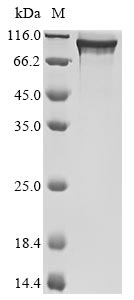 Greater than 90% as determined by SDS-PAGE.Recombinant Human Protein Pat1 Homolog 1 (PATL1) Protein (His)
