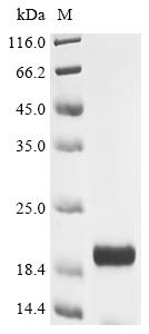 Greater than 90% as determined by SDS-PAGE.Recombinant Human Adamts-Like Protein 2 (ADAMTSL2) Protein (His&Myc)