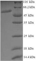 Greater than 90% as determined by SDS-PAGE.