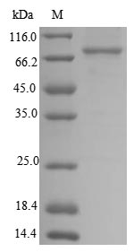 Greater than 85% as determined by SDS-PAGE.Recombinant Human Transforming Growth Factor Beta Activator Lrrc33 (NRROS) Protein (His&Myc)