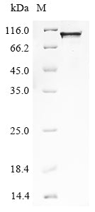 Greater than 85% as determined by SDS-PAGE.Recombinant Human Protein Mono-Adp-Ribosyltransferase Tiparp (TIPARP) Protein (His)