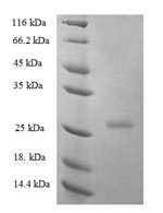 Greater than 90% as determined by SDS-PAGE.Recombinant Human Interferon Epsilon (IFNE) Protein (His)