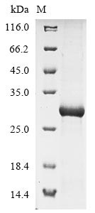 Greater than 85% as determined by SDS-PAGE.Recombinant Mouse C-Type Lectin Domain Family 4 Member G (CLEC4G) Protein (His)