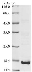 Greater than 85% as determined by SDS-PAGE.Recombinant Mouse Isoleucine--Trna Ligase,Cytoplasmic (IARS1) Protein (His&Myc)