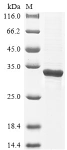 Greater than 85% as determined by SDS-PAGE.Recombinant Mouse Enoyl-Coa Hydratase,Mitochondrial (ECHS1) Protein (His&Myc)