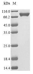 Greater than 85% as determined by SDS-PAGE.Recombinant Mouse Cap-specific mRNA (CMTR2) Protein (His)