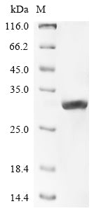 Greater than 90% as determined by SDS-PAGE.Recombinant Mouse Carbamoyl-Phosphate Synthase [Ammonia], Mitochondrial (CPS1) Protein (His)