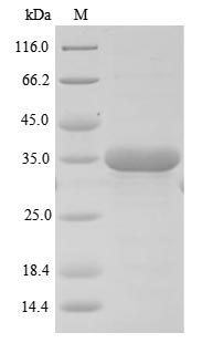 Greater than 85% as determined by SDS-PAGE.Recombinant Mouse Sushi Domain-Containing Protein 4 (SUSD4) Protein (His)