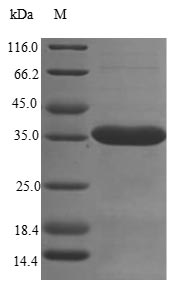 Greater than 85% as determined by SDS-PAGE.Recombinant Mouse Sushi Domain-Containing Protein 4 (SUSD4) Protein (His)