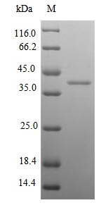 Greater than 90% as determined by SDS-PAGE.Recombinant Mouse Kallikrein-14 (KLK14) Protein (His-SUMO)