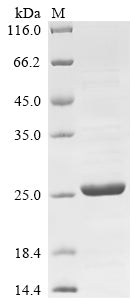 Greater than 85% as determined by SDS-PAGE.Recombinant Mouse Ras-Related Protein Rab-44 (RAB44) Protein (His&Myc)