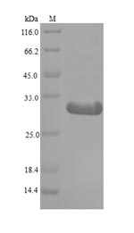 Greater than 90% as determined by SDS-PAGE.Recombinant Mouse Histone Deacetylase Complex Subunit Sap130 (SAP130) Protein (His)