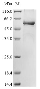 Greater than 85% as determined by SDS-PAGE.Recombinant Human Tryptophan 5-Hydroxylase 2 (TPH2) Protein (His)