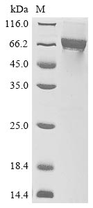 Greater than 85% as determined by SDS-PAGE.Recombinant Crimean-Congo Hemorrhagic Fever Virus Envelopment Polyprotein (GP) Protein (MBP&His)