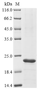 Greater than 85% as determined by SDS-PAGE.Recombinant Mouse Adropin (ENHO) Protein (His-KSI)