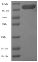 Greater than 90% as determined by SDS-PAGE.Recombinant Mouse Hydroxymethylglutaryl-Coa Synthase, Cytoplasmic Domain (HMGCS1) Protein (His-SUMO)
