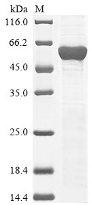 Greater than 85% as determined by SDS-PAGE.Recombinant Mouse Leucine-Rich Repeat Lgi Family Member 3 (LGI3) Protein (His)
