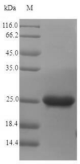 Greater than 90% as determined by SDS-PAGE.Recombinant Vibrio Vulnificus Fe/S Biogenesis Protein Nfua (NFUA) Protein (His)