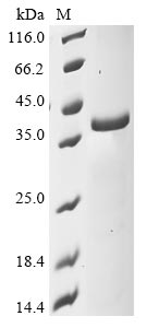 Greater than 85% as determined by SDS-PAGE.Recombinant Mouse Nad-Dependent Protein Deacylase Sirtuin-5, Mitochondrial (SIRT5) Protein (His&Myc)