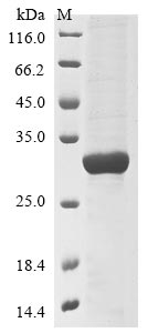 Greater than 90% as determined by SDS-PAGE.Recombinant Human Poly [Adp-Ribose] Polymerase 9 (PARP9) Protein (His)