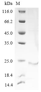 Greater than 85% as determined by SDS-PAGE.Recombinant Human Probable Atp-Dependent Rna Helicase Ddx60 (DDX60) Protein (His)
