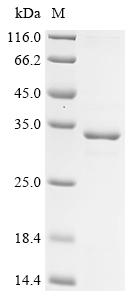 Greater than 85% as determined by SDS-PAGE.Recombinant Mouse Mucin-4 (MUC4) Protein (His&Myc)