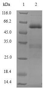 Greater than 90% as determined by SDS-PAGE.Recombinant Human E3 Ubiquitin-Protein Ligase Siah1 (SIAH1) Protein (GST)