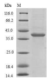 Greater than 90% as determined by SDS-PAGE.Recombinant Human Bh3-Like Motif-Containing Cell Death Inducer (BLID) Protein (GST)