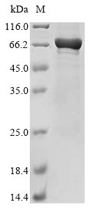 Greater than 85% as determined by SDS-PAGE.Recombinant Human Coiled-Coil Domain-Containing Protein 112 (CCDC112) Protein (His-SUMO)