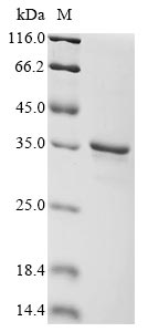 Greater than 90% as determined by SDS-PAGE.Recombinant Human Retinoic Acid-Induced Protein 3 (GPRC5A) Protein (GST)