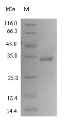 Greater than 90% as determined by SDS-PAGE.Recombinant Human Phosphoethanolamine/Phosphocholine Phosphatase (PHOSPHO1) Protein (His)