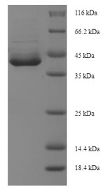 Greater than 90% as determined by SDS-PAGE.