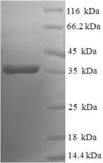 Greater than 90% as determined by SDS-PAGE.
