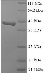 Greater than 90% as determined by SDS-PAGE.Recombinant Human Swi/Snf Complex Subunit Smarcc1 (SMARCC1) Protein (His-SUMO)