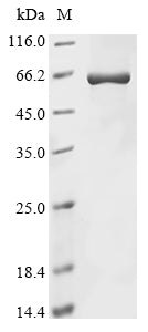 Greater than 85% as determined by SDS-PAGE.Recombinant Rabbit Beta-Arrestin-1 (ARRB1) Protein (His)