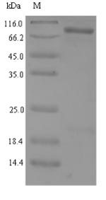 Greater than 90% as determined by SDS-PAGE.Recombinant Human Nad-Dependent Protein Deacetylase Sirtuin-1 (SIRT1) Protein (His)