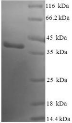 Greater than 90% as determined by SDS-PAGE.Recombinant Human Sentrin-Specific Protease 8 (SENP8) Protein (His-SUMO)