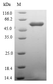 Greater than 90% as determined by SDS-PAGE.Recombinant Human Ring Finger And Chy Zinc Finger Domain-Containing Protein 1 (RCHY1) Protein (GST)