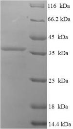 Greater than 90% as determined by SDS-PAGE.