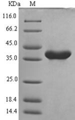 Greater than 90% as determined by SDS-PAGE.Recombinant Mouse Nacht, Lrr And Pyd Domains-Containing Protein 3 (NLRP3) Protein (His-SUMO)