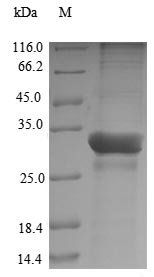 Greater than 90% as determined by SDS-PAGE.Recombinant Theragra Chalcogramma Parvalbumin Beta-1 Protein (His-sumo&Myc)