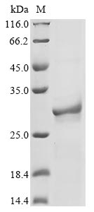 Greater than 85% as determined by SDS-PAGE.Recombinant Mouse Nicotinamide Riboside Kinase 1 (NRK1) Protein (His)