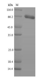 Greater than 90% as determined by SDS-PAGE.Recombinant Human Patatin-Like Phospholipase Domain-Containing Protein 2 (PNPLA2) Protein (His-SUMO)